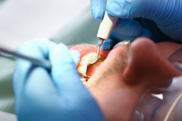 Best Emergency Tooth Extraction  in Baxter, MN