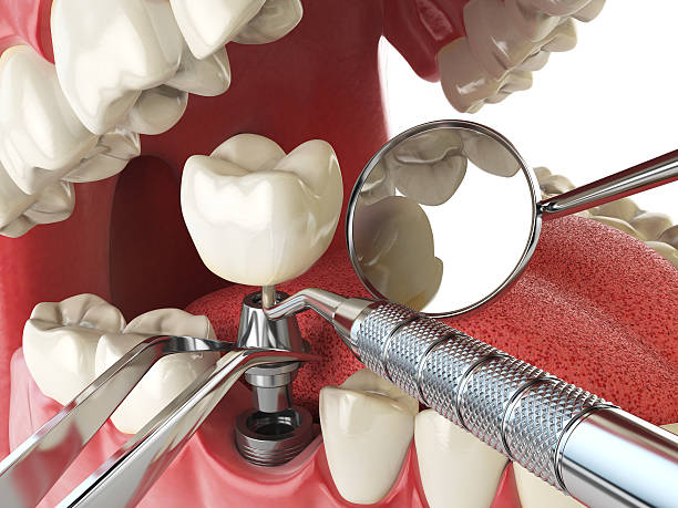 Best Tooth Pain Emergency Relief  in Baxter, MN